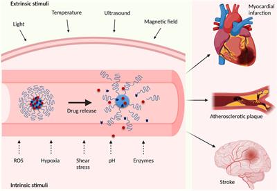 On-Demand Drug Delivery: Recent Advances in Cardiovascular Applications